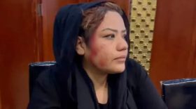 حمله خونین طالبان به زنان